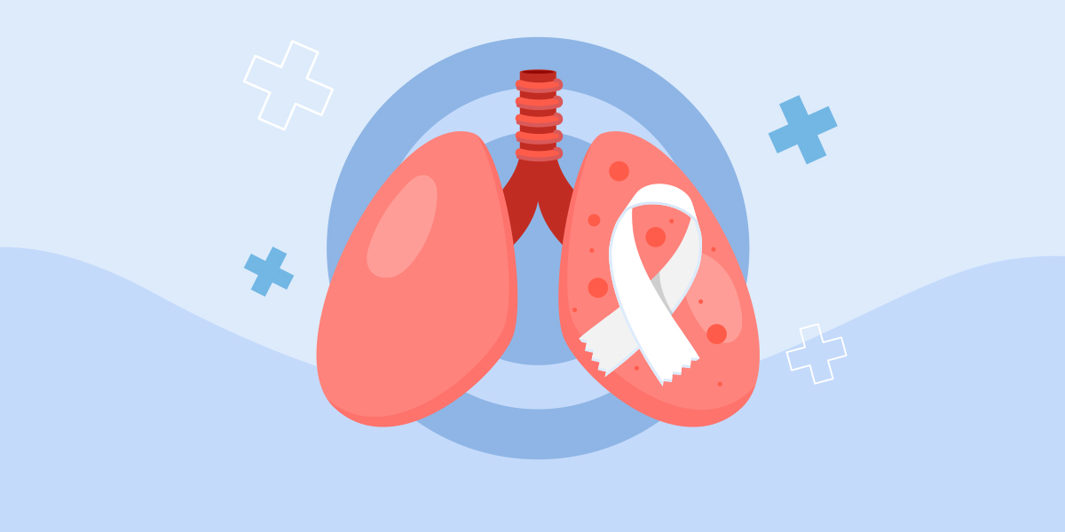 New lung cancer screening campaign in Monaco