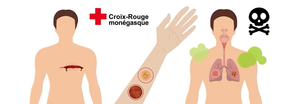 Premiers Secours Que faire face à une plaie ou des brûlures?